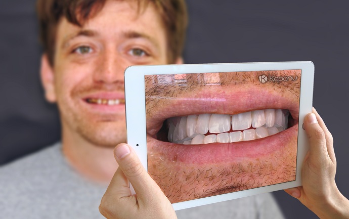 آینه مجازی لبخندتان را قبل از جراحی دندان نشان می‌دهد