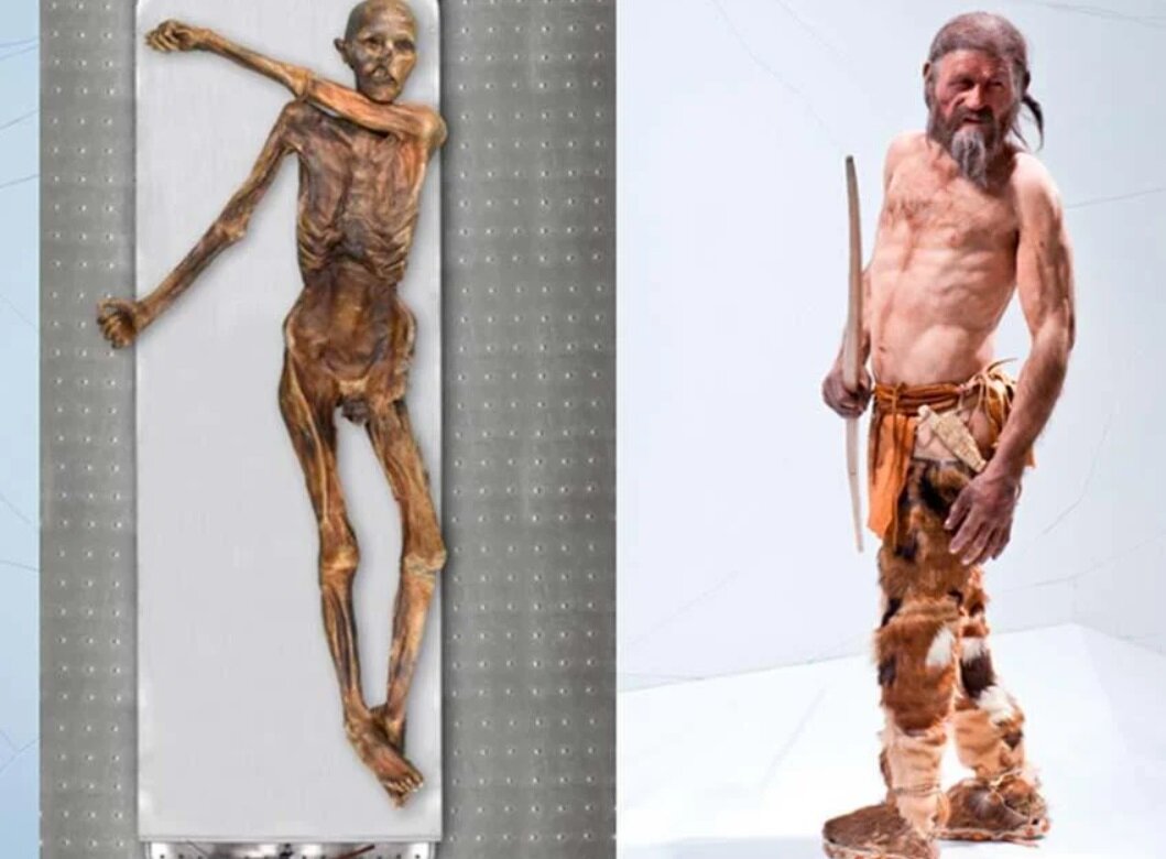 Otzi