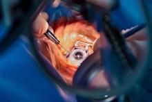 بیماری چشمی