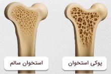 پوکی