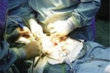 ۱۸ هزار مورد سرقت از اعضای بدن سوری‌ها