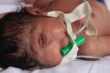 انتشار گسترده تصویر "نوزاد شبیه به دجال" در فضای مجازی جهان عرب +عکس