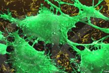 نرم افزار پزشکی پیش بینی سرطان 