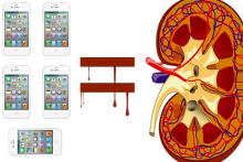 یک نوجوان برای خرید گوشی آیفون، کلیه‌اش را فروخت!