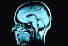 اختلالات در بافت سفید مغز معتادان به اینترنت 