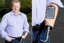 اولین دست مصنوعی که تلفن همراه شد! 