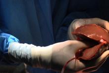 صدور کارت "اهدای عضو" الکترونیکی شد