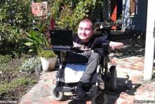 متخصص نرم&zwnj;افزار روس داوطلب پیوند سر شد (+عکس)