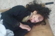 18+/ تجاوز وحشیانه داعش به دختر نوجوان شیعه (+عکس دختر نگون بخت) 