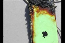 سوختگی شدید یک نوجوان توسط آیفون در حال شارژ (+تصاویر) 