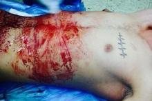 18+/ حادثه&zwnj;ای شرم آور در جامعه پزشکی؛ اینستاگرام بازی با بدن بیمار (+عکس)