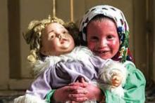 حمایت سازمان تامین اجتماعی از کودک مبتلا به بیماری پوستی در بجنورد