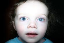 نابینا شدن نوزاد سه ماهه به دلیل فلاش دوربین