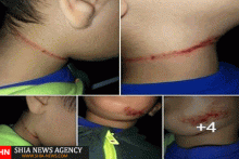 به دار آویختن هولناک دانش آموز 5 ساله مسلمان در بلژیک!