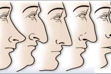 شخصیت شناسی از روی فرم چانه صورت (+عکس)