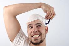 چرا مردان کچل اعتماد به نفس بیشتری دارند؟