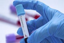 تشخیص کرونا با کیت&zwnj;های ایرانی ممکن شد