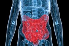 یک توصیه مهم برای پیشگیری از سرطان روده بزرگ