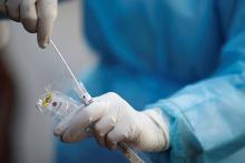  وجود آنتی بادی کرونا در خون، از ابتلای مجدد پیشگیری کند