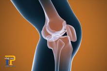 اگر مبتلا به آرتروز هستید، این خوراکی ها را حتما میل کنید