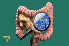 باکتری های روده عامل فشارخون بالا