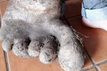 شباهت عجیب سیب‌زمینی به عضوی از بدن انسان