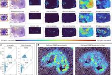 نحوه تشخیص سرطان توسط هوش‌ مصنوعی