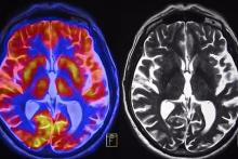 هوش مصنوعی پاسخ می‌دهد: آیا مغز زنان و مردان متفاوت است؟