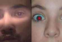 تشخیص سلامت چشم&zwnj;ها از رنگ مردمک فرد در عکس&zwnj;های یادگاری 