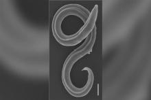 زنده شدن یک کرم منجمد پس از ۴۶ هزار سال!