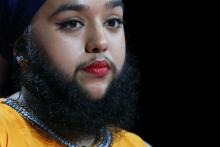 ریش 15 سانتی دختر بریتانیایی در گینس ثبت شد (+عکس)