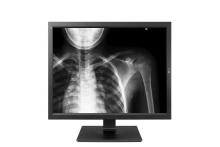 رونمایی از دستگاه نمایشگرهای پزشکی ال‌جی در نمایشگاه MEDICA 2017 