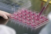 از بین بردن سلول&zwnj;های سرطانی با سوراخ کردنشان ممکن شد