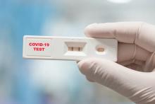 ایمنی چهار ماهه مقابل کرونا پس از عفونت خفیف یا بدون علامت