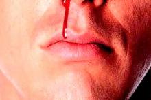 درگیری عجیب و خونین زن و شوهر به خاطر ورود یک موش به اتاق خواب!