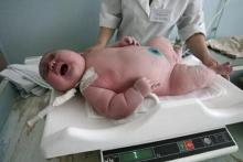 این نوزاد مشهدی سنگین وزن ترین نوزاد متولد شده جهان است؟