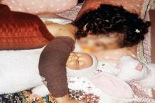 حمله سگ‌های ولگرد به دختربچه سه ساله در کرج