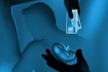 همدستی فقر و تلگرام برای حراج تکه‌ای از جان