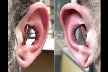 جراحی عجیب گوش برای افزایش فالوور