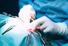 زن 37 ساله جانش را بر سر زیباشدن گذاشت