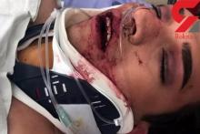 تجاوز وحشیانه به پسر دوجنسه در خیابان پشت پارک