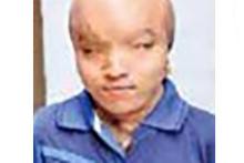 عمل زیبایی پسر عجیب و غریب برای ازدواج با دختر زیبا (+عکس)