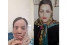 چهره عروس جوان تهرانی با اسید سوخت (+عکس قبل و بعد از حادثه)
