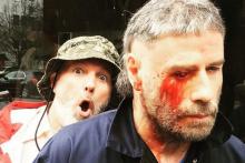 قیافه عجیب جان تراولتا؛ بازیگری که همه چیز را از دست داد