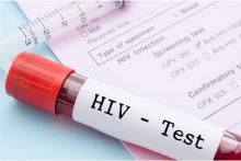 آخرین آمار ابتلا به ایدز در کشور