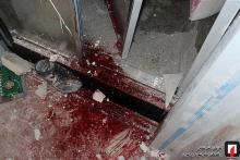 سر یک کارگر بین آسانسور و دیوار گیر افتاد