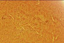 ثبت تصویری متفاوت از خورشید