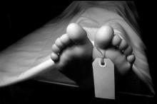 جزئیات مرگ یک زن پس از عمل جراحی در شمال تهران