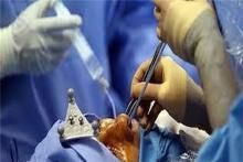 خطر مرگ در کدام عمل‌های زیبایی بیشتر است؟