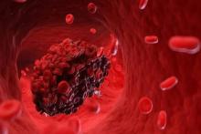 افزایش خطر لختگی خون با این دو قرص پرمصرف